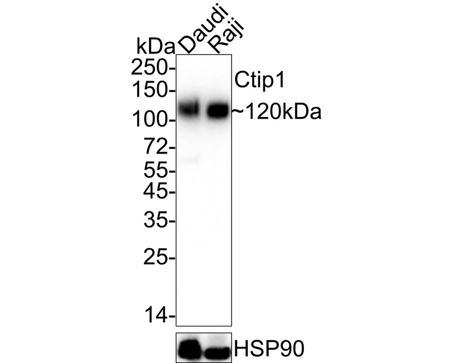 Immunohistochemical analysis of paraffin-embedded human lymph nodes tissue with Rabbit anti-Ctip1 antibody (ET7107-38) at 1/800 dilution.<br />
<br />
The section was pre-treated using heat mediated antigen retrieval with sodium citrate buffer (pH 6.0) for 2 minutes. The tissues were blocked in 1% BSA for 20 minutes at room temperature, washed with ddH2O and PBS, and then probed with the primary antibody (ET7107-38) at 1/800 dilution for 1 hour at room temperature. The detection was performed using an HRP conjugated compact polymer system. DAB was used as the chromogen. Tissues were counterstained with hematoxylin and mounted with DPX.