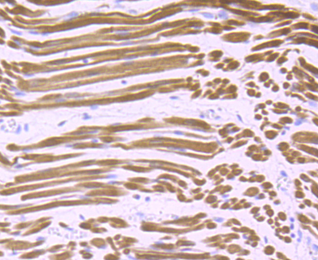 Immunohistochemical analysis of paraffin-embedded human fetal skeletal muscle tissue using anti-Calsequestrin 1 antibody. Counter stained with hematoxylin.