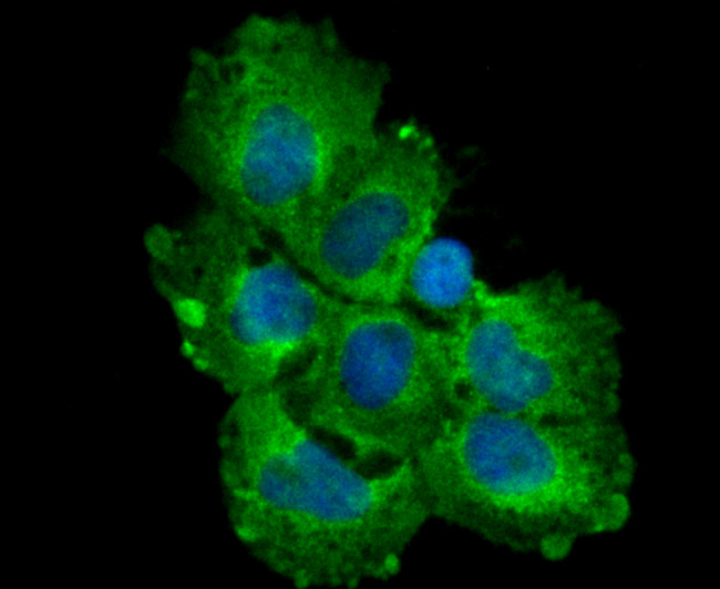 ICC staining TGF alpha in A549 cells (green). The nuclear counter stain is DAPI (blue). Cells were fixed in paraformaldehyde, permeabilised with 0.25% Triton X100/PBS.