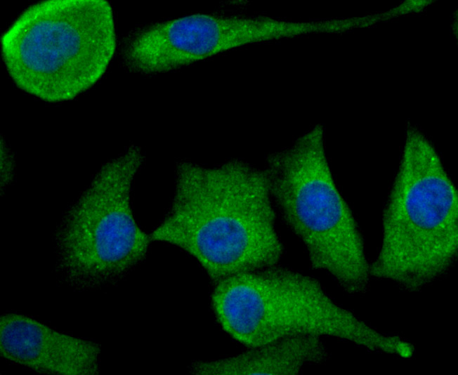 ICC staining TGF alpha in PC-3M cells (green). The nuclear counter stain is DAPI (blue). Cells were fixed in paraformaldehyde, permeabilised with 0.25% Triton X100/PBS.
