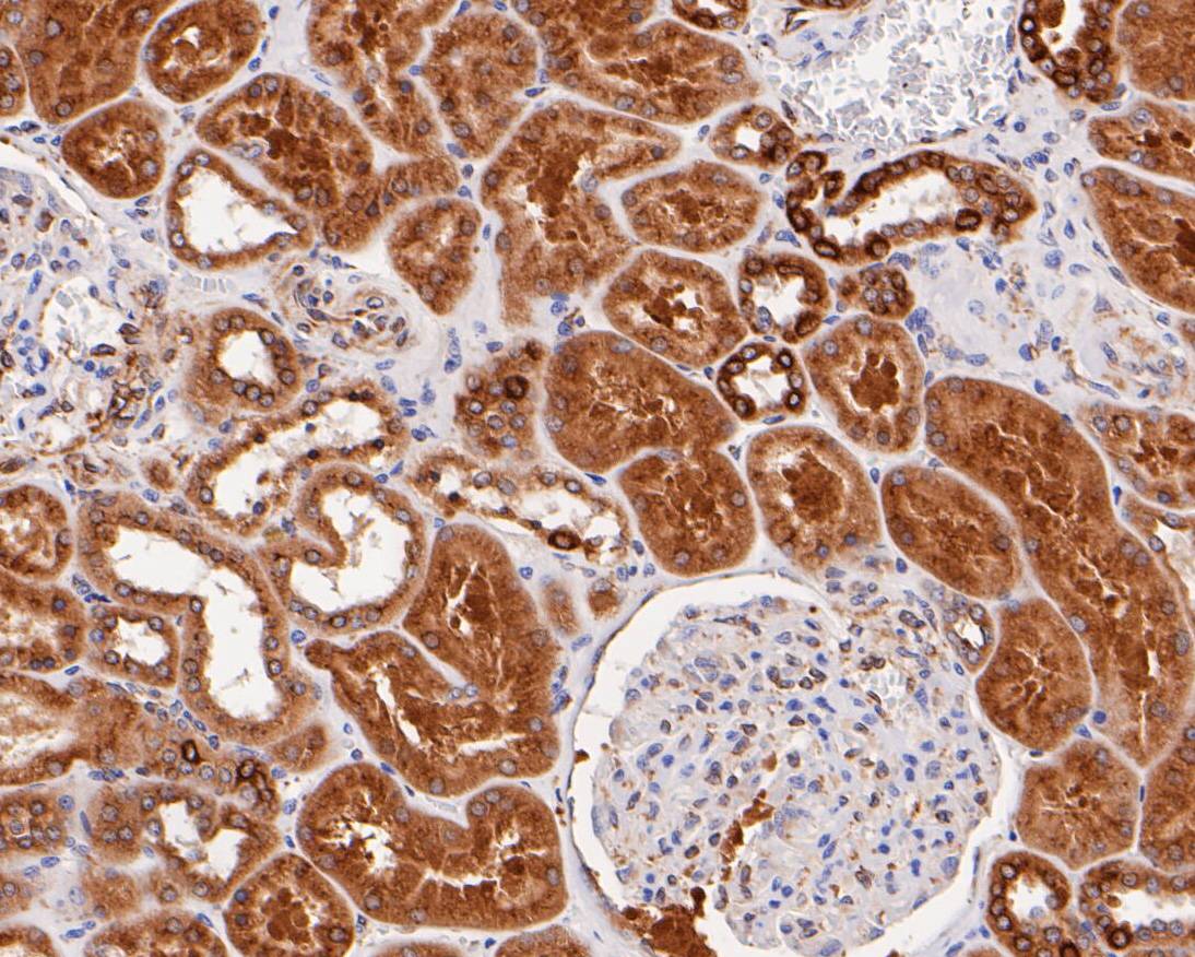 Immunohistochemical analysis of paraffin-embedded human tonsil tissue using anti-TGF alpha antibody. Counter stained with hematoxylin.