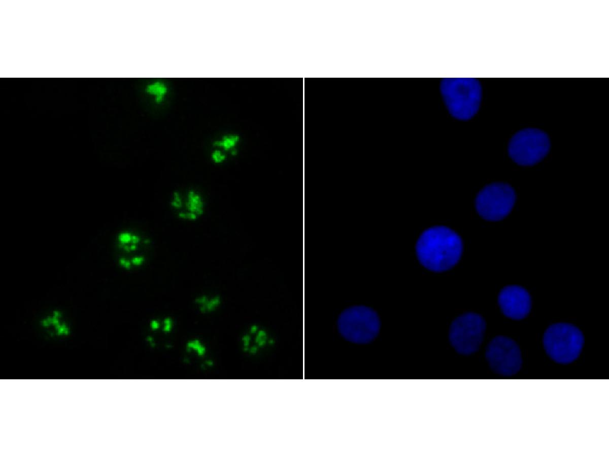 ICC staining of KDM5A in A549 cells (green). Formalin fixed cells were permeabilized with 0.1% Triton X-100 in TBS for 10 minutes at room temperature and blocked with 10% negative goat serum for 15 minutes at room temperature. Cells were probed with the primary antibody (ET7107-43, 1/50) for 1 hour at room temperature, washed with PBS. Alexa Fluor®488 conjugate-Goat anti-Rabbit IgG was used as the secondary antibody at 1/1,000 dilution. The nuclear counter stain is DAPI (blue).