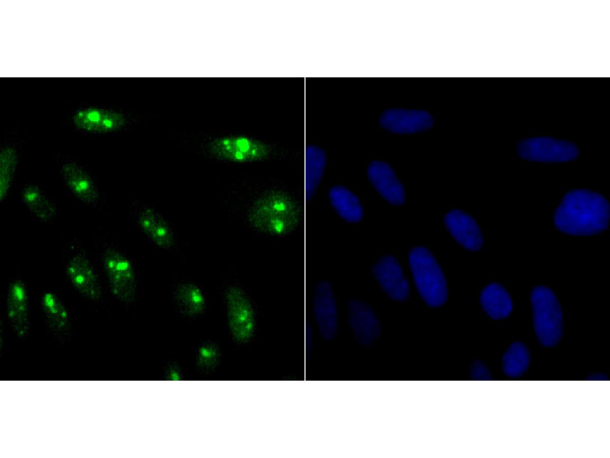 ICC staining of KDM5A in SiHa cells (green). Formalin fixed cells were permeabilized with 0.1% Triton X-100 in TBS for 10 minutes at room temperature and blocked with 10% negative goat serum for 15 minutes at room temperature. Cells were probed with the primary antibody (ET7107-43, 1/50) for 1 hour at room temperature, washed with PBS. Alexa Fluor®488 conjugate-Goat anti-Rabbit IgG was used as the secondary antibody at 1/1,000 dilution. The nuclear counter stain is DAPI (blue).