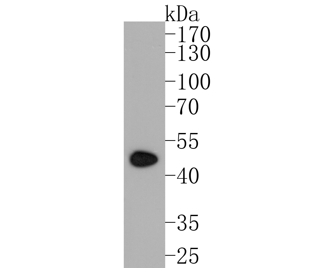 Western blot analysis of PDK2 on rat heart tissue lysates. Proteins were transferred to a PVDF membrane and blocked with 5% BSA in PBS for 1 hour at room temperature. The primary antibody (ET7107-46, 1/500) was used in 5% BSA at room temperature for 2 hours. Goat Anti-Rabbit IgG - HRP Secondary Antibody (HA1001) at 1:5,000 dilution was used for 1 hour at room temperature.