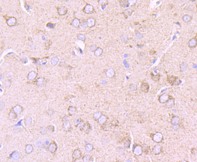 Immunohistochemical analysis of paraffin-embedded rat brain tissue using anti-PDK2 antibody. The section was pre-treated using heat mediated antigen retrieval with Tris-EDTA buffer (pH 8.0-8.4) for 20 minutes.The tissues were blocked in 5% BSA for 30 minutes at room temperature, washed with ddH2O and PBS, and then probed with the primary antibody (ET7107-46, 1/50) for 30 minutes at room temperature. The detection was performed using an HRP conjugated compact polymer system. DAB was used as the chromogen. Tissues were counterstained with hematoxylin and mounted with DPX.