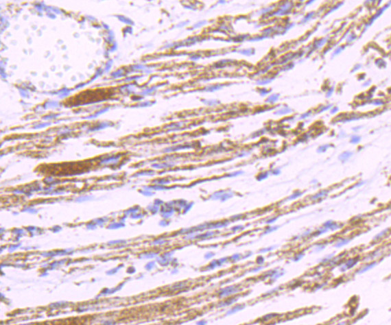 Immunohistochemical analysis of paraffin-embedded human fetal skeletal muscle tissue using anti-PDK2 antibody. The section was pre-treated using heat mediated antigen retrieval with Tris-EDTA buffer (pH 8.0-8.4) for 20 minutes.The tissues were blocked in 5% BSA for 30 minutes at room temperature, washed with ddH2O and PBS, and then probed with the primary antibody (ET7107-46, 1/50) for 30 minutes at room temperature. The detection was performed using an HRP conjugated compact polymer system. DAB was used as the chromogen. Tissues were counterstained with hematoxylin and mounted with DPX.