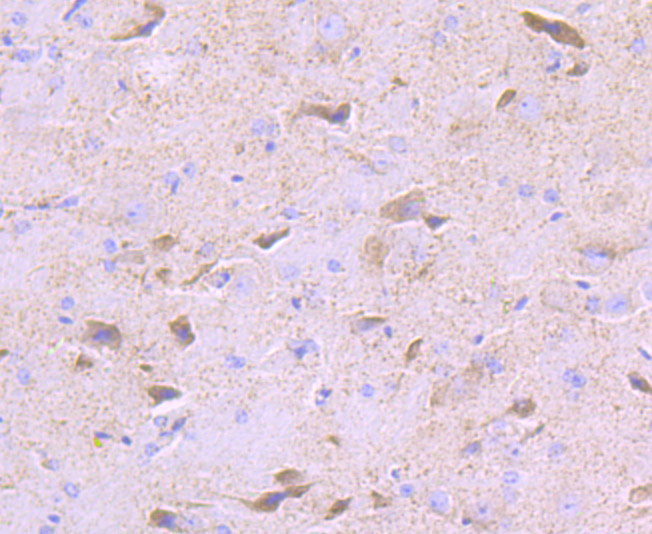 Immunohistochemical analysis of paraffin-embedded mouse cerebellum tissue using anti-PDK2 antibody. The section was pre-treated using heat mediated antigen retrieval with Tris-EDTA buffer (pH 8.0-8.4) for 20 minutes.The tissues were blocked in 5% BSA for 30 minutes at room temperature, washed with ddH2O and PBS, and then probed with the primary antibody (ET7107-46, 1/50) for 30 minutes at room temperature. The detection was performed using an HRP conjugated compact polymer system. DAB was used as the chromogen. Tissues were counterstained with hematoxylin and mounted with DPX.
