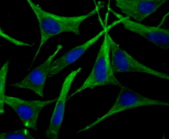 ICC staining of Apolipoprotein A II in SH-SY5Y cells (green). Formalin fixed cells were permeabilized with 0.1% Triton X-100 in TBS for 10 minutes at room temperature and blocked with 10% negative goat serum for 15 minutes at room temperature. Cells were probed with the primary antibody (ET7107-47, 1/50) for 1 hour at room temperature, washed with PBS. Alexa Fluor®488 conjugate-Goat anti-Rabbit IgG was used as the secondary antibody at 1/1,000 dilution. The nuclear counter stain is DAPI (blue).