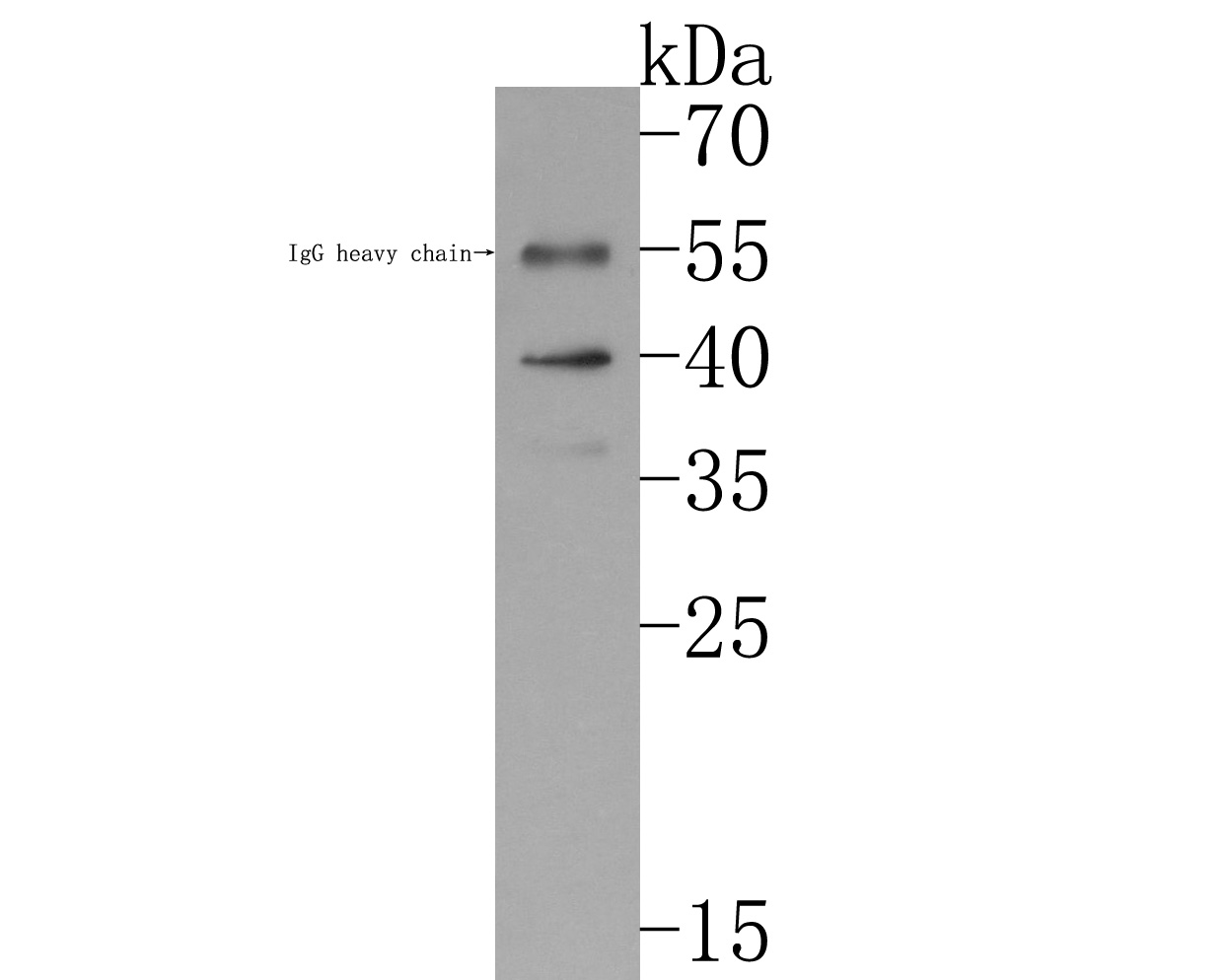 Western blot analysis of Biglycan on human skin tissue lysates. Proteins were transferred to a PVDF membrane and blocked with 5% BSA in PBS for 1 hour at room temperature. The primary antibody (ET7107-48, 1/500) was used in 5% BSA at room temperature for 2 hours. Goat Anti-Rabbit IgG - HRP Secondary Antibody (HA1001) at 1:200,000 dilution was used for 1 hour at room temperature.
