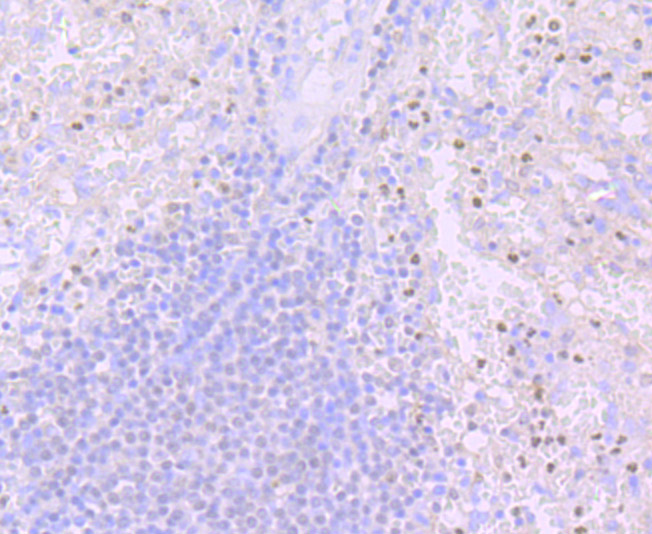 Immunohistochemical analysis of paraffin-embedded human spleen tissue using anti-PU.1/Spi1 antibody. The section was pre-treated using heat mediated antigen retrieval with Tris-EDTA buffer (pH 8.0-8.4) for 20 minutes.The tissues were blocked in 5% BSA for 30 minutes at room temperature, washed with ddH2O and PBS, and then probed with the primary antibody (ET7107-49, 1/50) for 30 minutes at room temperature. The detection was performed using an HRP conjugated compact polymer system. DAB was used as the chromogen. Tissues were counterstained with hematoxylin and mounted with DPX.
