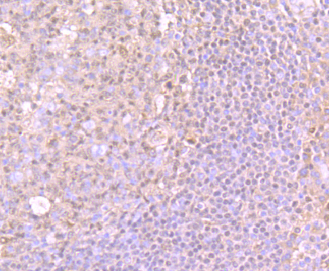 Immunohistochemical analysis of paraffin-embedded human tonsil tissue using anti-PU.1/Spi1 antibody. The section was pre-treated using heat mediated antigen retrieval with Tris-EDTA buffer (pH 8.0-8.4) for 20 minutes.The tissues were blocked in 5% BSA for 30 minutes at room temperature, washed with ddH2O and PBS, and then probed with the primary antibody (ET7107-49, 1/50) for 30 minutes at room temperature. The detection was performed using an HRP conjugated compact polymer system. DAB was used as the chromogen. Tissues were counterstained with hematoxylin and mounted with DPX.