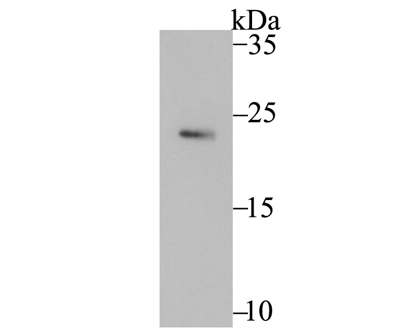 Western blot analysis of Securin on SiHa cell lysate using anti-Securin antibody at 1/500 dilution.