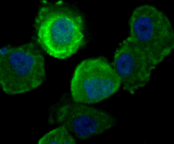ICC staining Securin in HUVEC cells (green). The nuclear counter stain is DAPI (blue). Cells were fixed in paraformaldehyde, permeabilised with 0.25% Triton X100/PBS.