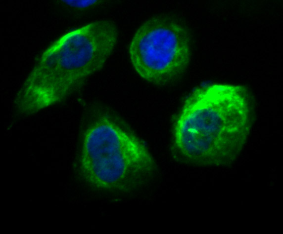 ICC staining Securin in PC-3M cells (green). The nuclear counter stain is DAPI (blue). Cells were fixed in paraformaldehyde, permeabilised with 0.25% Triton X100/PBS.