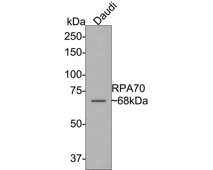 Western blot analysis of RPA70 on Hela cell lysates with Rabbit anti-RPA70 antibody (ET7107-51) at 1/500 dilution.<br />
<br />
Lysates/proteins at 10 µg/Lane.<br />
<br />
Predicted band size: 92 kDa<br />
Observed band size: 92 kDa<br />
<br />
Exposure time: 2 minutes;<br />
<br />
10% SDS-PAGE gel.<br />
<br />
Proteins were transferred to a PVDF membrane and blocked with 5% NFDM/TBST for 1 hour at room temperature. The primary antibody (ET7107-51) at 1/500 dilution was used in 5% NFDM/TBST at room temperature for 2 hours. Goat Anti-Rabbit IgG - HRP Secondary Antibody (HA1001) at 1:300,000 dilution was used for 1 hour at room temperature.