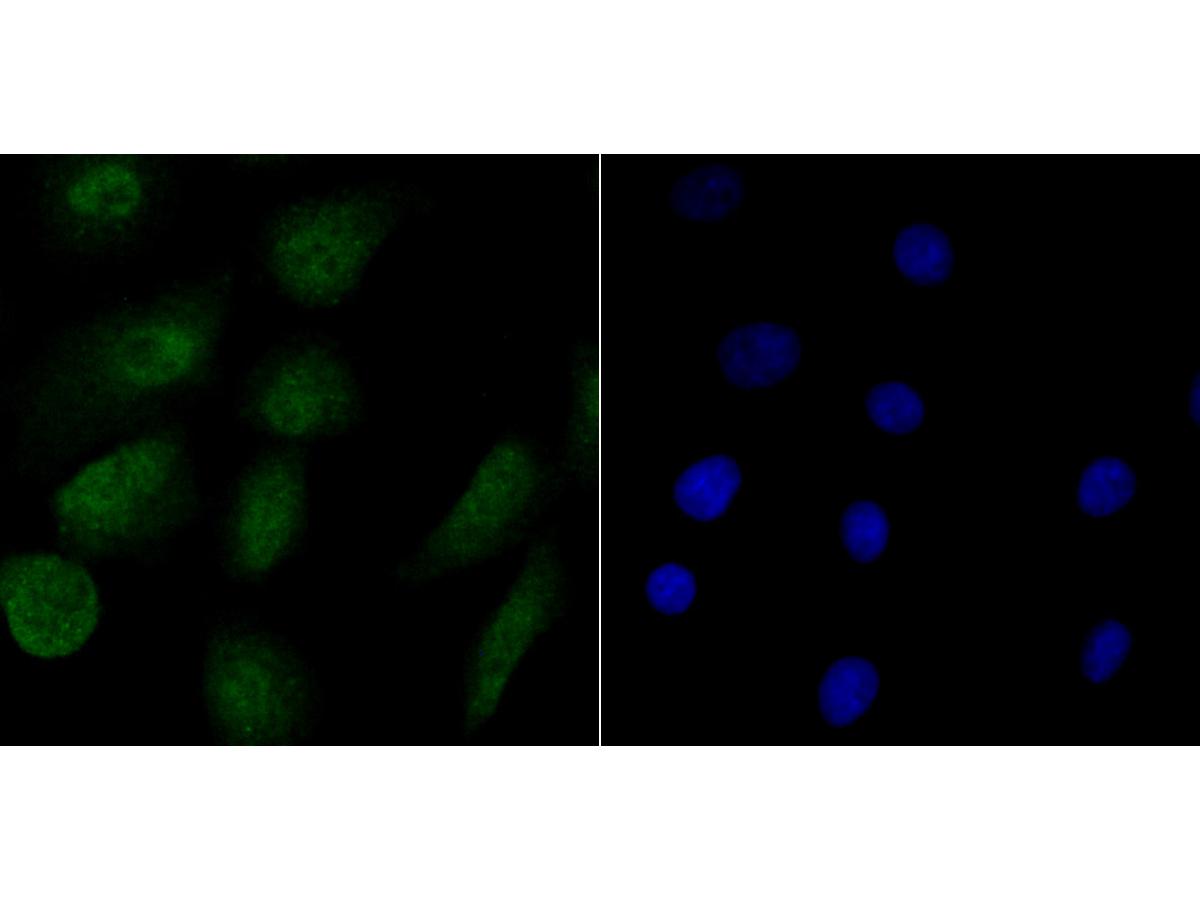ICC staining RPA70 in A549 cells (green). The nuclear counter stain is DAPI (blue). Cells were fixed in paraformaldehyde, permeabilised with 0.25% Triton X100/PBS.
