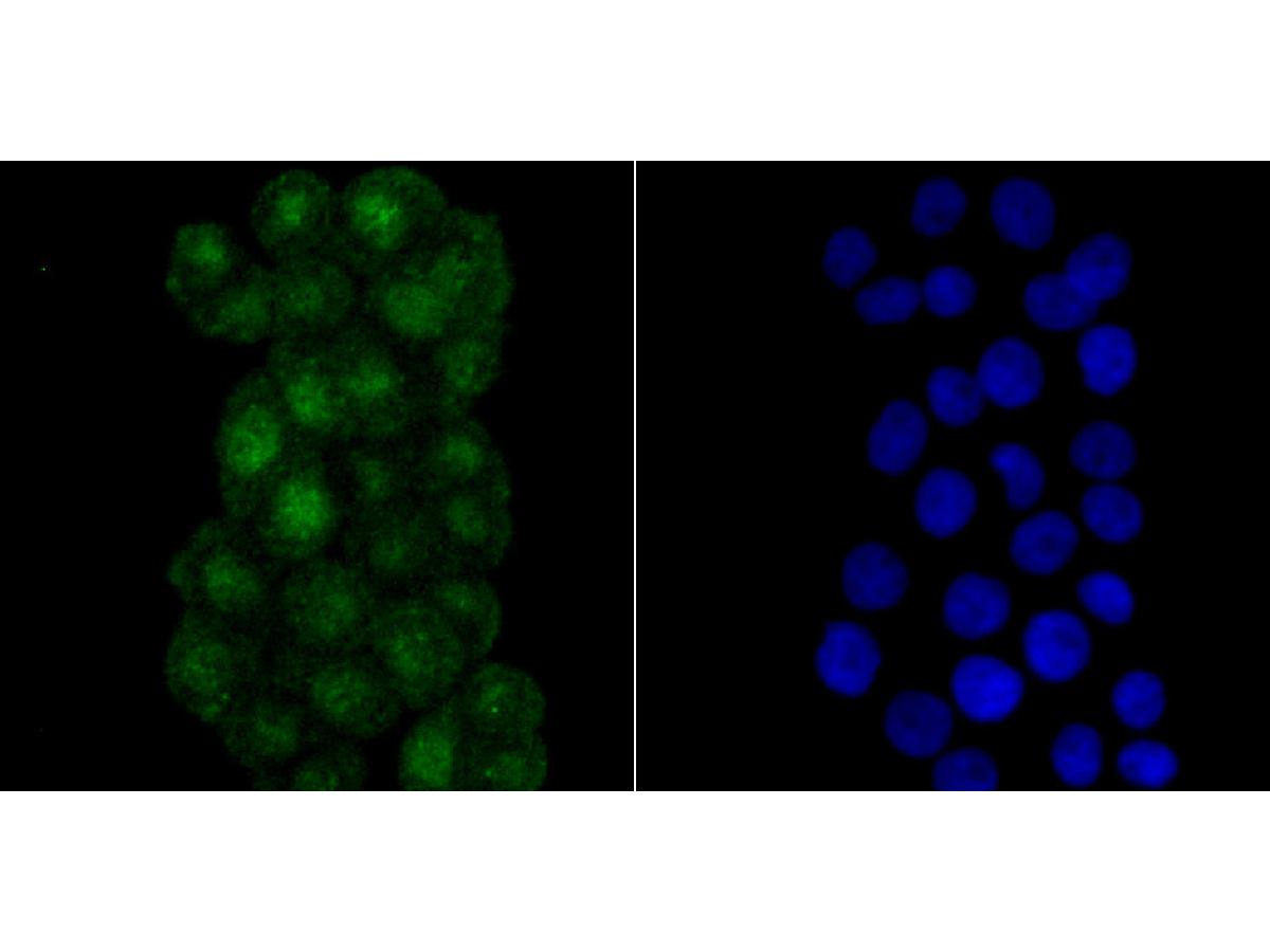 ICC staining RPA70 in LOVO cells (green). The nuclear counter stain is DAPI (blue). Cells were fixed in paraformaldehyde, permeabilised with 0.25% Triton X100/PBS.