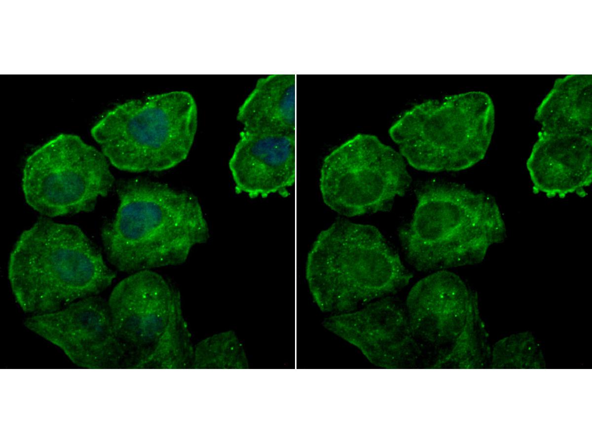 ICC staining of Galectin 7 in HUVEC cells (green). Formalin fixed cells were permeabilized with 0.1% Triton X-100 in TBS for 10 minutes at room temperature and blocked with 10% negative goat serum for 15 minutes at room temperature. Cells were probed with the primary antibody (ET7107-54, 1/50) for 1 hour at room temperature, washed with PBS. Alexa Fluor®488 conjugate-Goat anti-Rabbit IgG was used as the secondary antibody at 1/1,000 dilution. The nuclear counter stain is DAPI (blue).