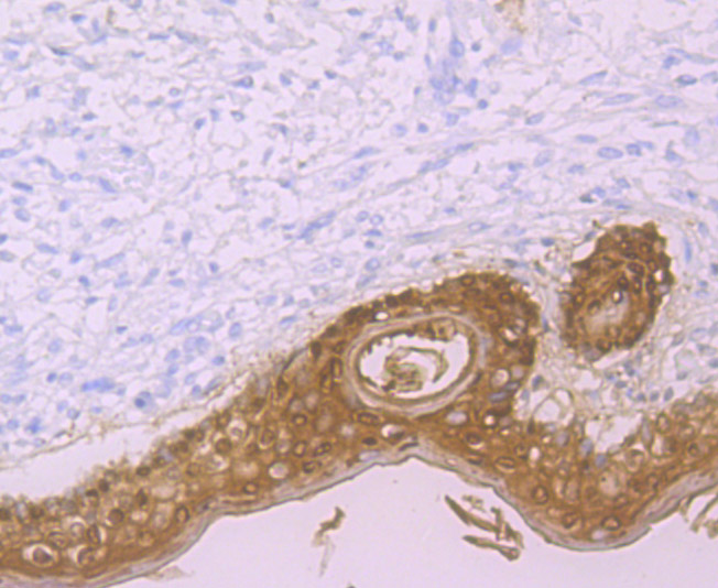 Immunohistochemical analysis of paraffin-embedded human skin tissue using anti-Galectin 7 antibody. The section was pre-treated using heat mediated antigen retrieval with Tris-EDTA buffer (pH 9.0) for 20 minutes.The tissues were blocked in 1% BSA for 30 minutes at room temperature, washed with ddH2O and PBS, and then probed with the primary antibody (ET7107-54, 1/50) for 30 minutes at room temperature. The detection was performed using an HRP conjugated compact polymer system. DAB was used as the chromogen. Tissues were counterstained with hematoxylin and mounted with DPX.