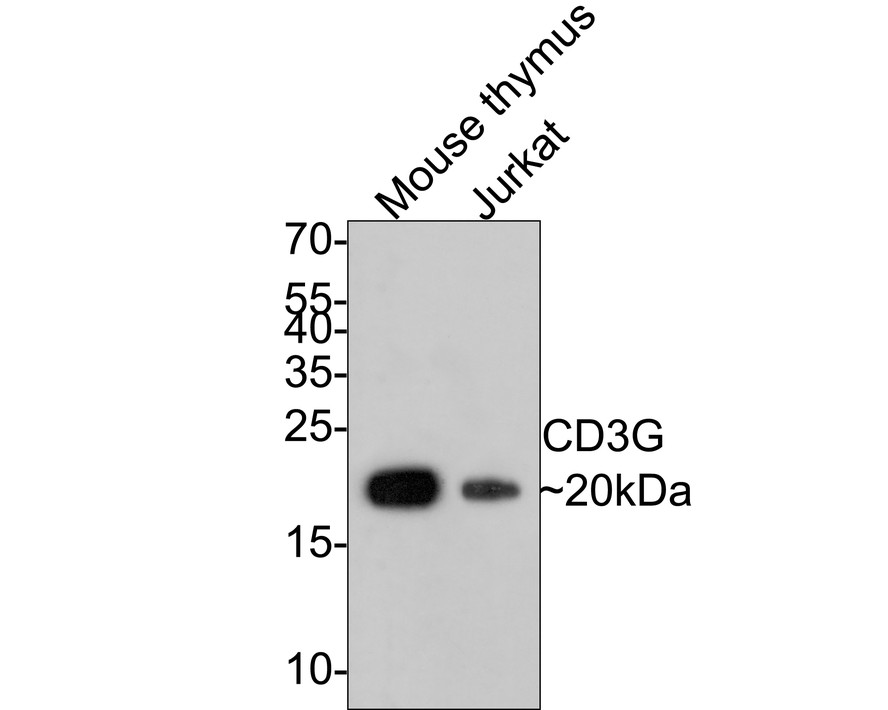 Western blot analysis of CD3G on different lysates with Rabbit anti-CD3G antibody (ET7107-55) at 1/500 dilution.<br />
<br />
Lane 1: Mouse thymus tissue lysate (20 µg/Lane)<br />
Lane 2: Jurkat cell lysate (10 µg/Lane)<br />
<br />
Predicted band size: 20 kDa<br />
Observed band size: 20 kDa<br />
<br />
Exposure time: 2 minutes;<br />
<br />
15% SDS-PAGE gel.<br />
<br />
Proteins were transferred to a PVDF membrane and blocked with 5% NFDM/TBST for 1 hour at room temperature. The primary antibody (ET7107-55) at 1/500 dilution was used in 5% NFDM/TBST at room temperature for 2 hours. Goat Anti-Rabbit IgG - HRP Secondary Antibody (HA1001) at 1:300,000 dilution was used for 1 hour at room temperature.