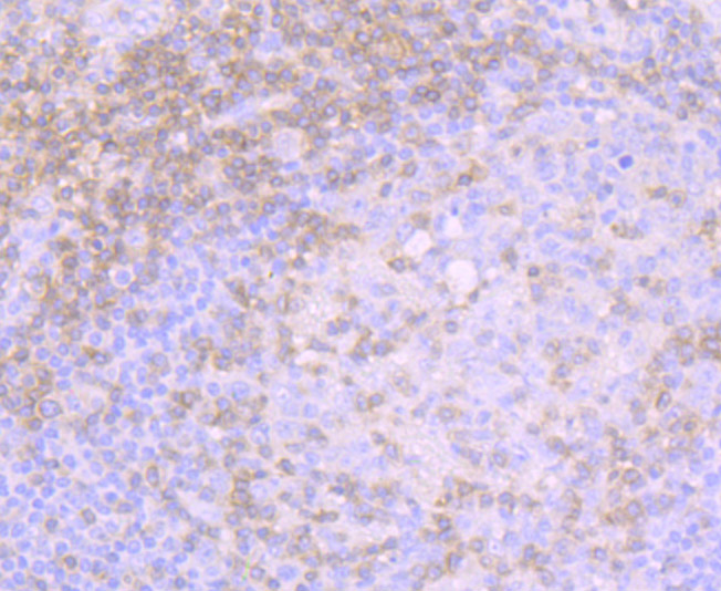 Immunohistochemical analysis of paraffin-embedded human tonsil tissue using anti-CD3G antibody. The section was pre-treated using heat mediated antigen retrieval with Tris-EDTA buffer (pH 8.0-8.4) for 20 minutes.The tissues were blocked in 5% BSA for 30 minutes at room temperature, washed with ddH2O and PBS, and then probed with the primary antibody (ET7107-55, 1/50) for 30 minutes at room temperature. The detection was performed using an HRP conjugated compact polymer system. DAB was used as the chromogen. Tissues were counterstained with hematoxylin and mounted with DPX.