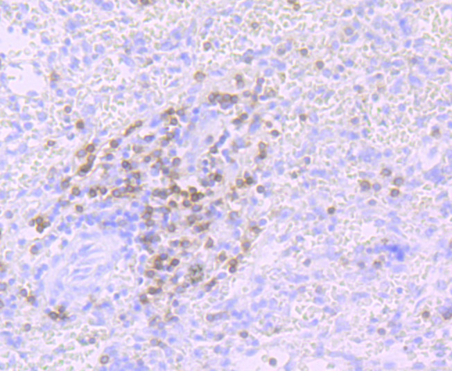 Immunohistochemical analysis of paraffin-embedded human spleen tissue using anti-CD3G antibody. The section was pre-treated using heat mediated antigen retrieval with Tris-EDTA buffer (pH 8.0-8.4) for 20 minutes.The tissues were blocked in 5% BSA for 30 minutes at room temperature, washed with ddH2O and PBS, and then probed with the primary antibody (ET7107-55, 1/50) for 30 minutes at room temperature. The detection was performed using an HRP conjugated compact polymer system. DAB was used as the chromogen. Tissues were counterstained with hematoxylin and mounted with DPX.