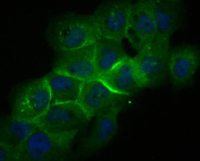 ICC staining of Galectin 8 in A431 cells (green). Formalin fixed cells were permeabilized with 0.1% Triton X-100 in TBS for 10 minutes at room temperature and blocked with 1% Blocker BSA for 15 minutes at room temperature. Cells were probed with the primary antibody (ET7107-56, 1/50) for 1 hour at room temperature, washed with PBS. Alexa Fluor®488 Goat anti-Rabbit IgG was used as the secondary antibody at 1/1,000 dilution. The nuclear counter stain is DAPI (blue).