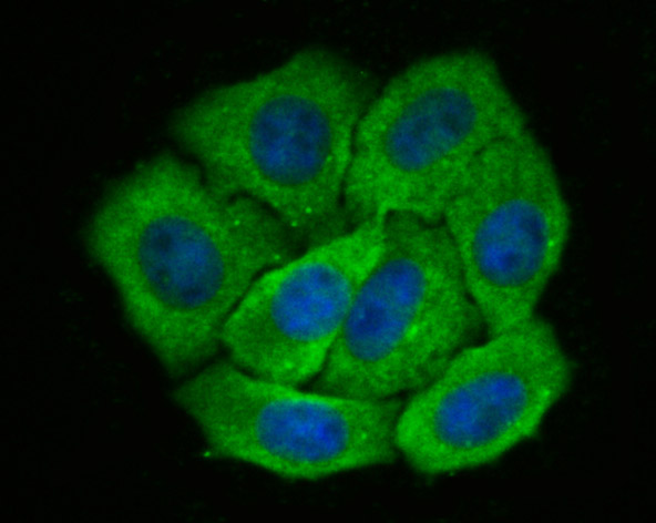 ICC staining of Galectin 8 in HepG2 cells (green). Formalin fixed cells were permeabilized with 0.1% Triton X-100 in TBS for 10 minutes at room temperature and blocked with 1% Blocker BSA for 15 minutes at room temperature. Cells were probed with the primary antibody (ET7107-56, 1/50) for 1 hour at room temperature, washed with PBS. Alexa Fluor®488 Goat anti-Rabbit IgG was used as the secondary antibody at 1/1,000 dilution. The nuclear counter stain is DAPI (blue).