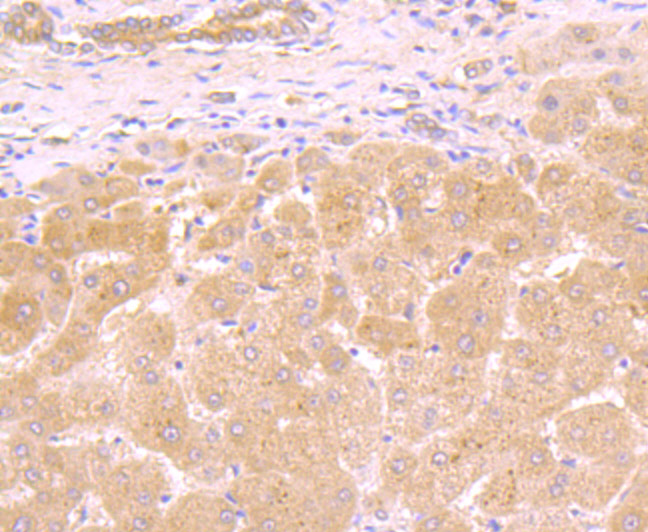 Immunohistochemical analysis of paraffin-embedded human liver tissue using anti-Galectin 8 antibody. The section was pre-treated using heat mediated antigen retrieval with Tris-EDTA buffer (pH 8.0-8.4) for 20 minutes.The tissues were blocked in 5% BSA for 30 minutes at room temperature, washed with ddH2O and PBS, and then probed with the primary antibody (ET7107-56, 1/50) for 30 minutes at room temperature. The detection was performed using an HRP conjugated compact polymer system. DAB was used as the chromogen. Tissues were counterstained with hematoxylin and mounted with DPX.