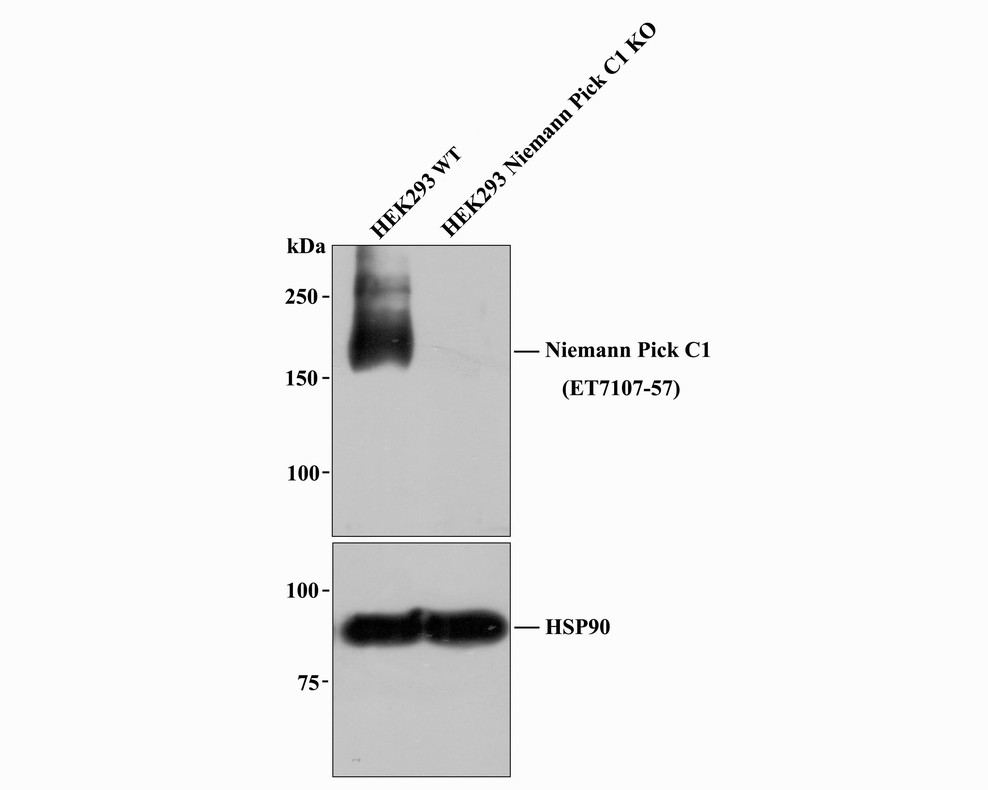 All lanes: Western blot analysis of Niemann Pick C1 with anti-Niemann Pick C1 antibody [JB87-33] (ET7107-57) at 1:1,000 dilution.<br />
Lane 1: Wild-type HEK293 whole cell lysate (20 µg).<br />
Lane 2: Niemann Pick C1 knockout HEK293 whole cell lysate (20 µg).<br />
<br />
ET7107-57 was shown to specifically react with Niemann Pick C1 in wild-type HEK293 cells. No band was observed when Niemann Pick C1 knockout sample was tested. Wild-type and Niemann Pick C1 knockout samples were subjected to SDS-PAGE. Proteins were transferred to a PVDF membrane and blocked with 5% NFDM in TBST for 1 hour at room temperature. The primary antibody (ET7107-57, 1/1,000) and Loading control antibody (Rabbit anti-HSP90, ET1605-56, 1/10,000) was used in 5% BSA at room temperature for 2 hours. Goat Anti-Rabbit IgG-HRP Secondary Antibody (HA1001) at 1:200,000 dilution was used for 1 hour at room temperature.