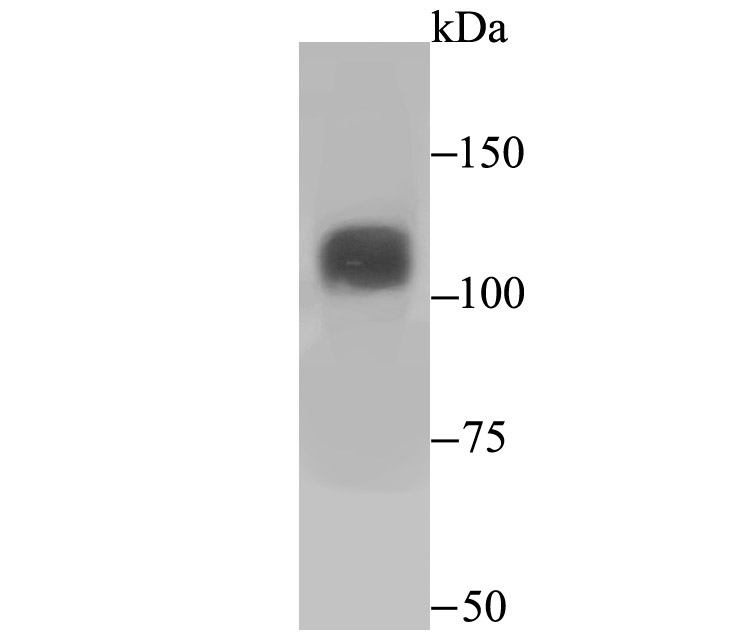 Western blot analysis of Niemann Pick C1 on SiHa cell lysates. Proteins were transferred to a PVDF membrane and blocked with 5% BSA in PBS for 1 hour at room temperature. The primary antibody (ET7107-57, 1/500) was used in 5% BSA at room temperature for 2 hours. Goat Anti-Rabbit IgG - HRP Secondary Antibody (HA1001) at 1:200,000 dilution was used for 1 hour at room temperature.