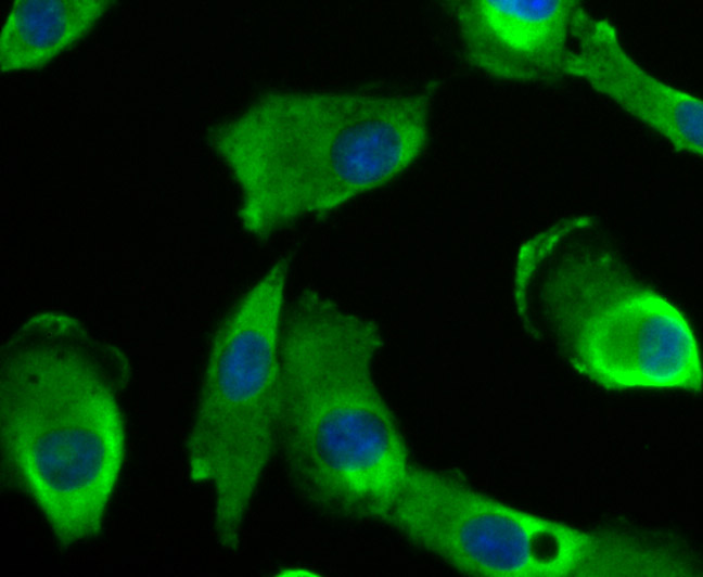 ICC staining of Niemann Pick C1 in A549 cells (green). Formalin fixed cells were permeabilized with 0.1% Triton X-100 in TBS for 10 minutes at room temperature and blocked with 1% Blocker BSA for 15 minutes at room temperature. Cells were probed with the primary antibody (ET7107-57, 1/50) for 1 hour at room temperature, washed with PBS. Alexa Fluor®488 Goat anti-Rabbit IgG was used as the secondary antibody at 1/1,000 dilution. The nuclear counter stain is DAPI (blue).