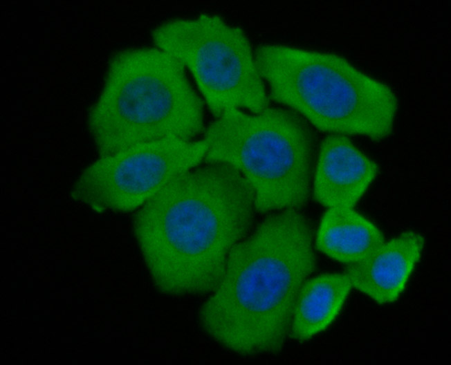 ICC staining of Niemann Pick C1 in HepG2 cells (green). Formalin fixed cells were permeabilized with 0.1% Triton X-100 in TBS for 10 minutes at room temperature and blocked with 1% Blocker BSA for 15 minutes at room temperature. Cells were probed with the primary antibody (ET7107-57, 1/50) for 1 hour at room temperature, washed with PBS. Alexa Fluor®488 Goat anti-Rabbit IgG was used as the secondary antibody at 1/1,000 dilution. The nuclear counter stain is DAPI (blue).