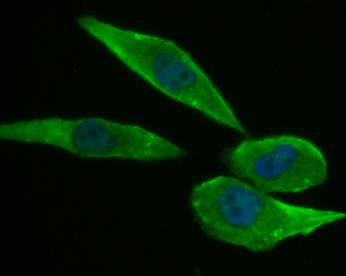 ICC staining of Niemann Pick C1 in PC-3M cells (green). Formalin fixed cells were permeabilized with 0.1% Triton X-100 in TBS for 10 minutes at room temperature and blocked with 1% Blocker BSA for 15 minutes at room temperature. Cells were probed with the primary antibody (ET7107-57, 1/50) for 1 hour at room temperature, washed with PBS. Alexa Fluor®488 Goat anti-Rabbit IgG was used as the secondary antibody at 1/1,000 dilution. The nuclear counter stain is DAPI (blue).