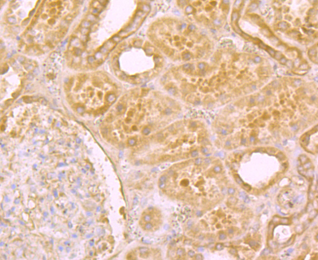 Immunohistochemical analysis of paraffin-embedded human kidney tissue using anti-Niemann Pick C1 antibody. The section was pre-treated using heat mediated antigen retrieval with Tris-EDTA buffer (pH 8.0-8.4) for 20 minutes.The tissues were blocked in 5% BSA for 30 minutes at room temperature, washed with ddH2O and PBS, and then probed with the primary antibody (ET7107-57, 1/50) for 30 minutes at room temperature. The detection was performed using an HRP conjugated compact polymer system. DAB was used as the chromogen. Tissues were counterstained with hematoxylin and mounted with DPX.