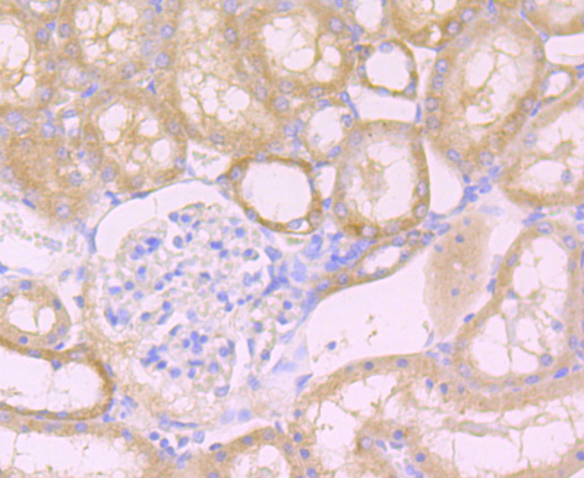 Immunohistochemical analysis of paraffin-embedded rat kidney tissue using anti-Niemann Pick C1 antibody. The section was pre-treated using heat mediated antigen retrieval with Tris-EDTA buffer (pH 8.0-8.4) for 20 minutes.The tissues were blocked in 5% BSA for 30 minutes at room temperature, washed with ddH2O and PBS, and then probed with the primary antibody (ET7107-57, 1/50) for 30 minutes at room temperature. The detection was performed using an HRP conjugated compact polymer system. DAB was used as the chromogen. Tissues were counterstained with hematoxylin and mounted with DPX.