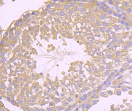 Immunohistochemical analysis of paraffin-embedded mouse testis tissue using anti-Niemann Pick C1 antibody. The section was pre-treated using heat mediated antigen retrieval with Tris-EDTA buffer (pH 8.0-8.4) for 20 minutes.The tissues were blocked in 5% BSA for 30 minutes at room temperature, washed with ddH2O and PBS, and then probed with the primary antibody (ET7107-57, 1/50) for 30 minutes at room temperature. The detection was performed using an HRP conjugated compact polymer system. DAB was used as the chromogen. Tissues were counterstained with hematoxylin and mounted with DPX.