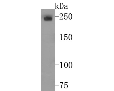 Western blot analysis of LY75 on THP-1 cell lysates. Proteins were transferred to a PVDF membrane and blocked with 5% BSA in PBS for 1 hour at room temperature. The primary antibody (ET7107-58, 1/500) was used in 5% BSA at room temperature for 2 hours. Goat Anti-Rabbit IgG - HRP Secondary Antibody (HA1001) at 1:200,000 dilution was used for 1 hour at room temperature.