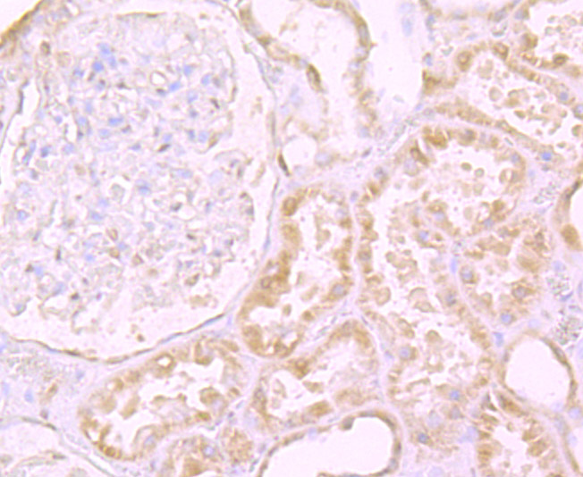 Immunohistochemical analysis of paraffin-embedded human kidney tissue using anti-LY75 antibody. The section was pre-treated using heat mediated antigen retrieval with Tris-EDTA buffer (pH 9.0) for 20 minutes.The tissues were blocked in 1% BSA for 30 minutes at room temperature, washed with ddH2O and PBS, and then probed with the primary antibody (ET7107-58, 1/50) for 30 minutes at room temperature. The detection was performed using an HRP conjugated compact polymer system. DAB was used as the chromogen. Tissues were counterstained with hematoxylin and mounted with DPX.