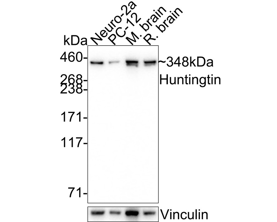 Western blot analysis of Huntingtin on different lysates. Proteins were transferred to a PVDF membrane and blocked with 5% BSA in PBS for 1 hour at room temperature. The primary antibody (ET7107-60, 1/500) was used in 5% BSA at room temperature for 2 hours. Goat Anti-Rabbit IgG - HRP Secondary Antibody (HA1001) at 1:200,000 dilution was used for 1 hour at room temperature.<br />
Positive control: <br />
Lane 1: SH-SY5Y cell lysate<br />
Lane 2: A431 cell lysate