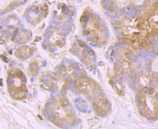 Immunohistochemical analysis of paraffin-embedded human breast tissue using anti-Huntingtin antibody. The section was pre-treated using heat mediated antigen retrieval with Tris-EDTA buffer (pH 9.0) for 20 minutes.The tissues were blocked in 1% BSA for 30 minutes at room temperature, washed with ddH2O and PBS, and then probed with the primary antibody (ET7107-60, 1/50) for 30 minutes at room temperature. The detection was performed using an HRP conjugated compact polymer system. DAB was used as the chromogen. Tissues were counterstained with hematoxylin and mounted with DPX.