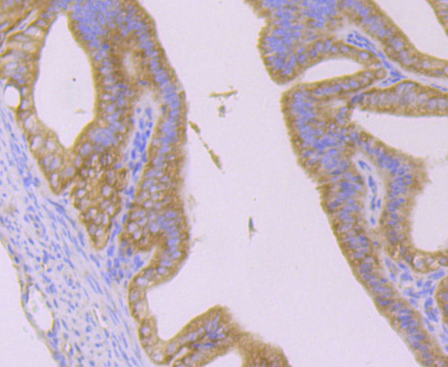 Immunohistochemical analysis of paraffin-embedded mouse epididymis tissue using anti-Huntingtin antibody. The section was pre-treated using heat mediated antigen retrieval with Tris-EDTA buffer (pH 9.0) for 20 minutes.The tissues were blocked in 1% BSA for 30 minutes at room temperature, washed with ddH2O and PBS, and then probed with the primary antibody (ET7107-60, 1/50) for 30 minutes at room temperature. The detection was performed using an HRP conjugated compact polymer system. DAB was used as the chromogen. Tissues were counterstained with hematoxylin and mounted with DPX.