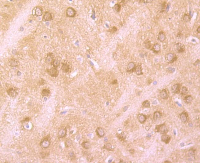 Immunohistochemical analysis of paraffin-embedded rat brain tissue using anti-Huntingtin antibody. The section was pre-treated using heat mediated antigen retrieval with Tris-EDTA buffer (pH 9.0) for 20 minutes.The tissues were blocked in 1% BSA for 30 minutes at room temperature, washed with ddH2O and PBS, and then probed with the primary antibody (ET7107-60, 1/50) for 30 minutes at room temperature. The detection was performed using an HRP conjugated compact polymer system. DAB was used as the chromogen. Tissues were counterstained with hematoxylin and mounted with DPX.