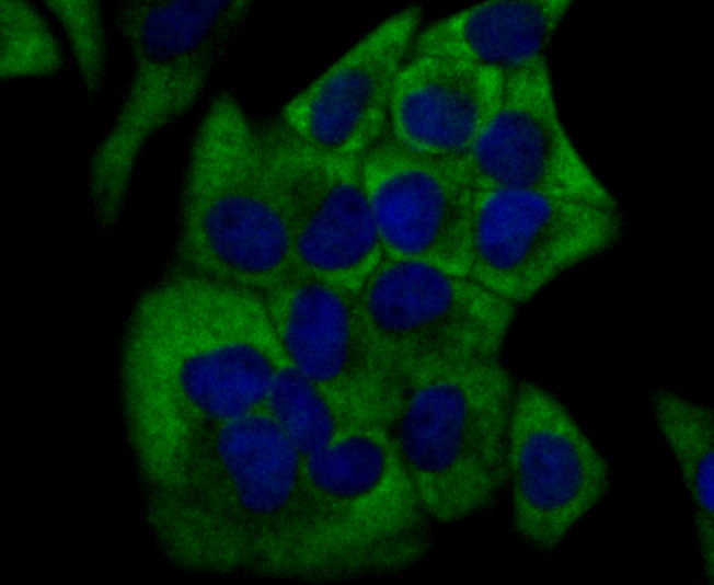 ICC staining Cytochrome P450 17A1 in Hela cells (green). The nuclear counter stain is DAPI (blue). Cells were fixed in paraformaldehyde, permeabilised with 0.25% Triton X100/PBS.