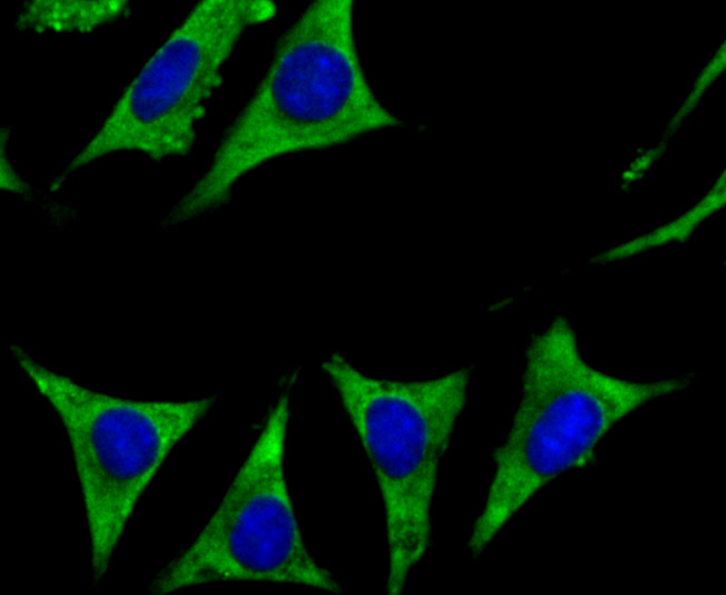 ICC staining Cytochrome P450 17A1 in SH-SY5Y cells (green). The nuclear counter stain is DAPI (blue). Cells were fixed in paraformaldehyde, permeabilised with 0.25% Triton X100/PBS.