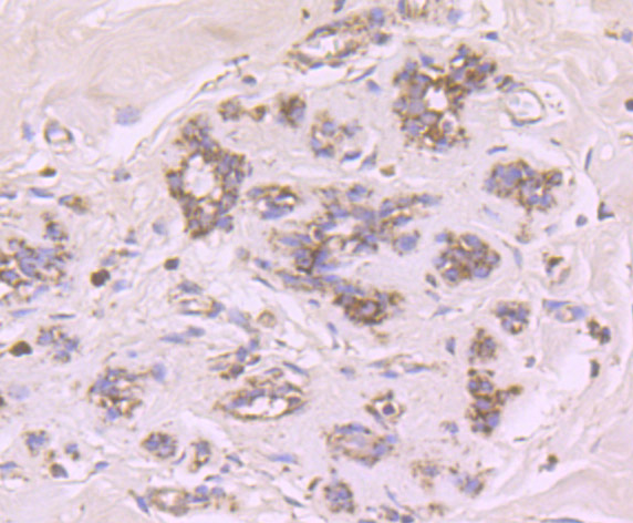 Immunohistochemical analysis of paraffin-embedded human breast tissue using anti-Cytochrome P450 17A1 antibody. Counter stained with hematoxylin.