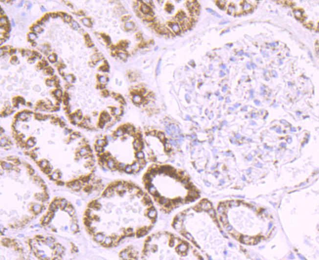 Immunohistochemical analysis of paraffin-embedded human kidney tissue using anti-Cytochrome P450 17A1 antibody. Counter stained with hematoxylin.