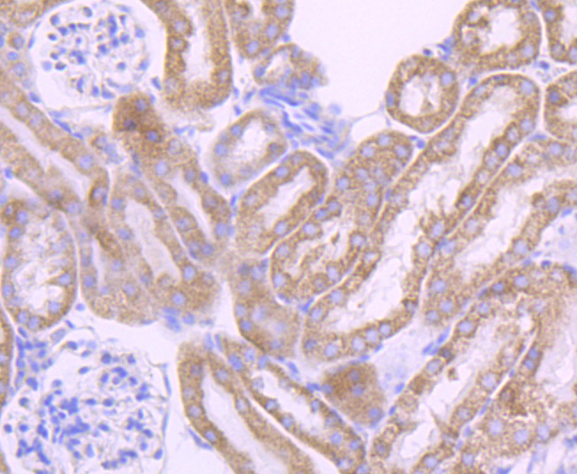 Immunohistochemical analysis of paraffin-embedded mouse kidney tissue using anti-Cytochrome P450 17A1 antibody. Counter stained with hematoxylin.