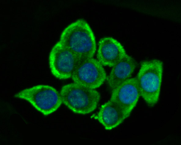 ICC staining of Glutathione Synthetase in LOVO cells (green). Formalin fixed cells were permeabilized with 0.1% Triton X-100 in TBS for 10 minutes at room temperature and blocked with 10% negative goat serum for 15 minutes at room temperature. Cells were probed with the primary antibody (ET7107-62, 1/50) for 1 hour at room temperature, washed with PBS. Alexa Fluor®488 conjugate-Goat anti-Rabbit IgG was used as the secondary antibody at 1/1,000 dilution. The nuclear counter stain is DAPI (blue).