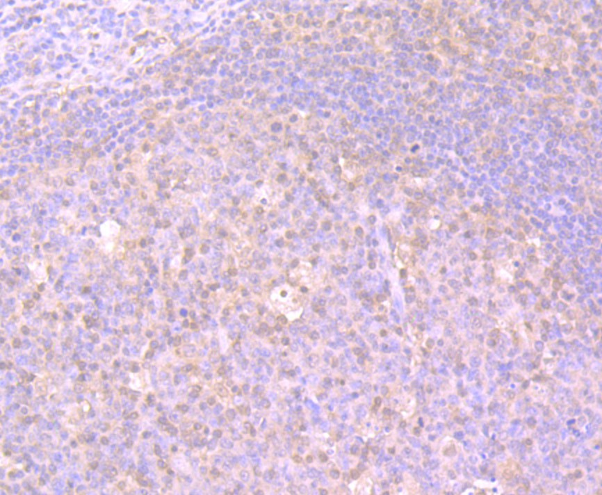 Immunohistochemical analysis of paraffin-embedded human tonsil tissue using anti-Glutathione Synthetase antibody. The section was pre-treated using heat mediated antigen retrieval with Tris-EDTA buffer (pH 9.0) for 20 minutes.The tissues were blocked in 1% BSA for 30 minutes at room temperature, washed with ddH2O and PBS, and then probed with the primary antibody (ET7107-62, 1/50) for 30 minutes at room temperature. The detection was performed using an HRP conjugated compact polymer system. DAB was used as the chromogen. Tissues were counterstained with hematoxylin and mounted with DPX.